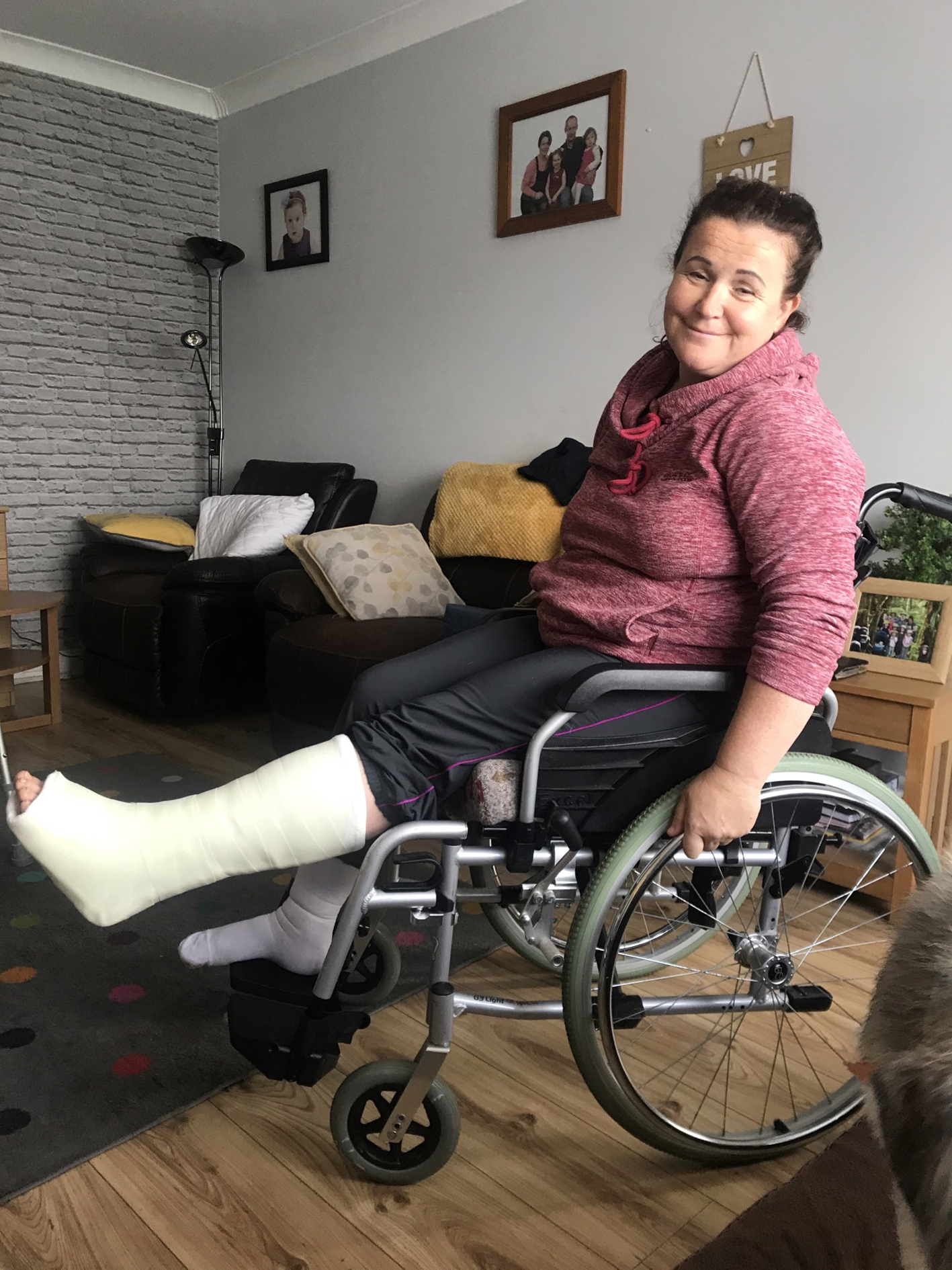 Omagh woman left with disability after beach fall