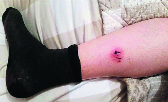 Vicious dog attack on couple at Strabane Canal